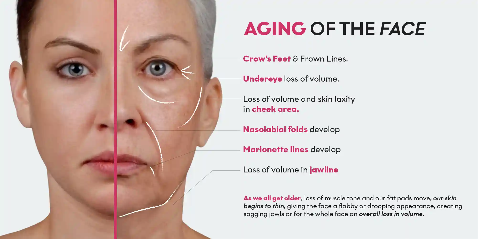Non-surgical facelift